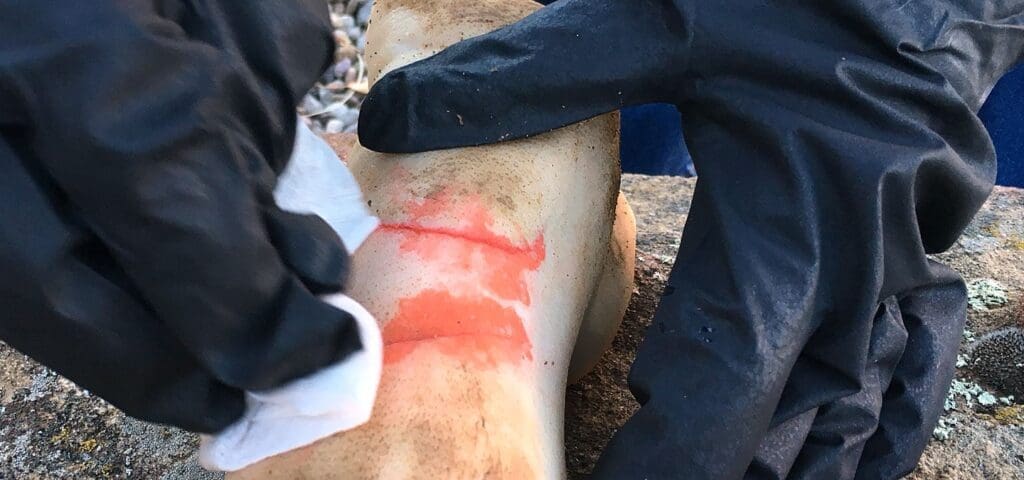 Critical Skills For Treating Injuries And Wounds In A Survival Situation